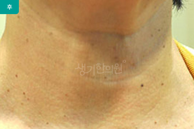 27-1%25EB%2591%2590%25EB%2593%259C%25EB%259F%25AC%25EA%25B8%25B0.jpg
