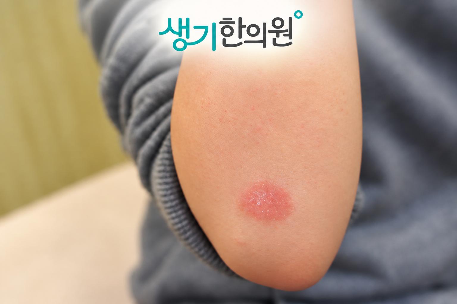 증상 참고 사진과 생기한의원 로고