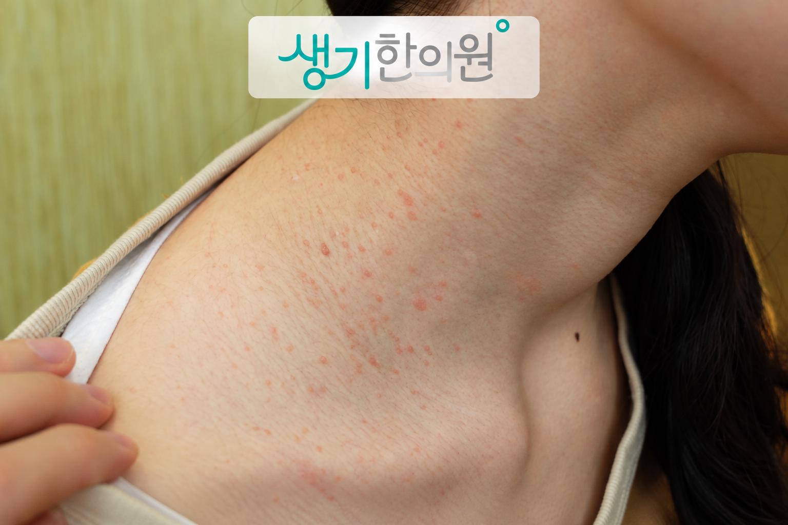 증상 참고 사진과 생기한의원 로고