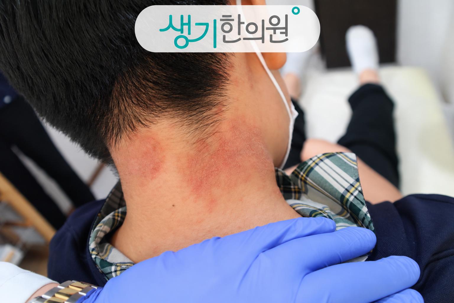 증상 참고 사진과 생기한의원 로고
