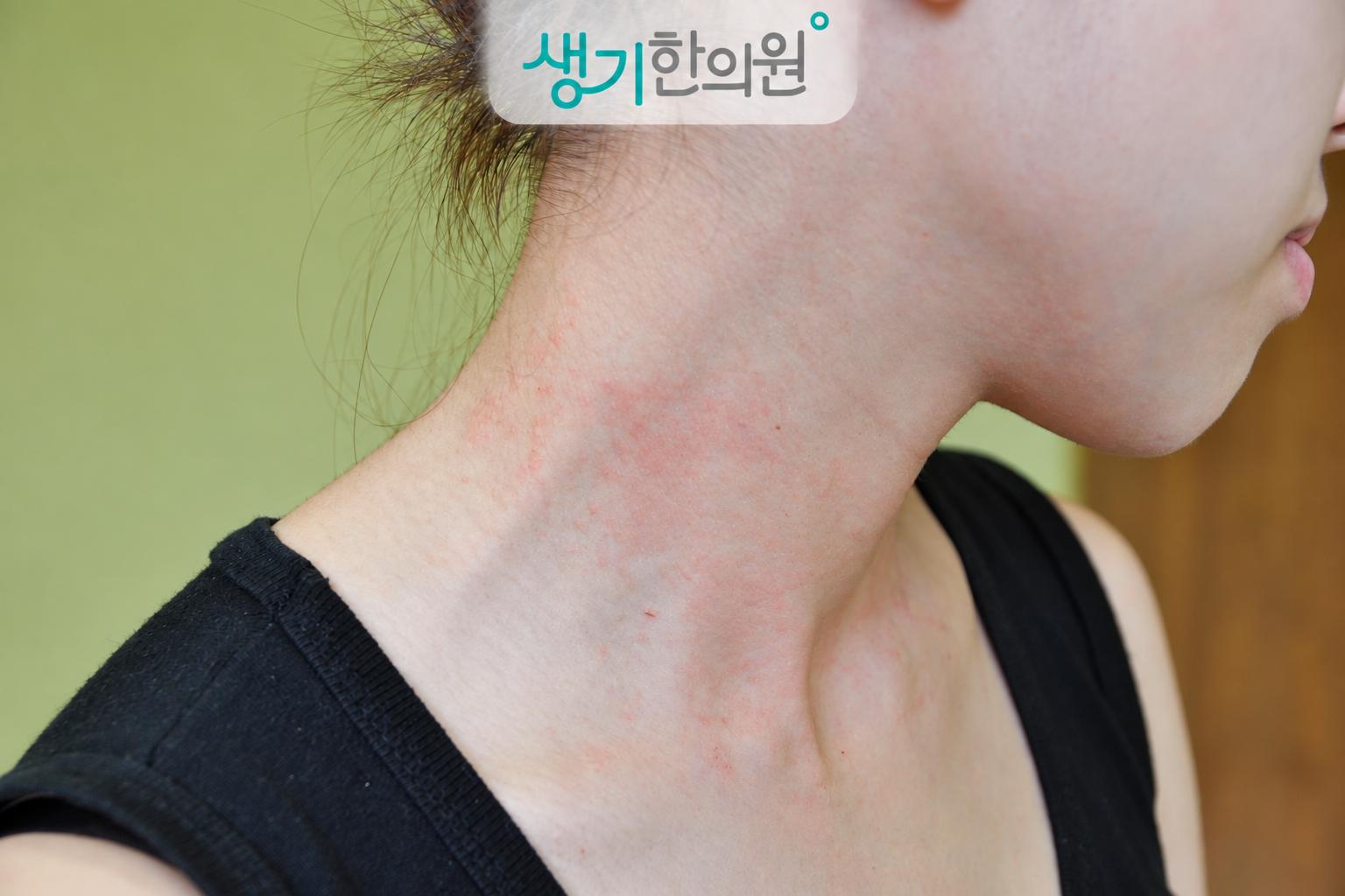증상 참고 사진과 생기한의원 로고