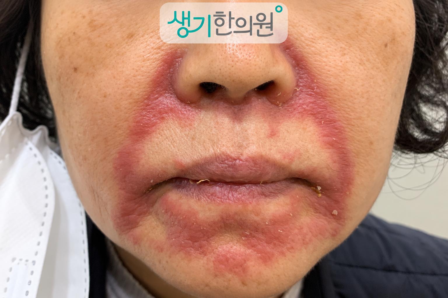 증상 참고 사진과 생기한의원 로고